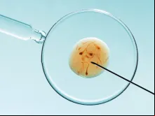Imagem ilustrativa de uma fertilização in vitro