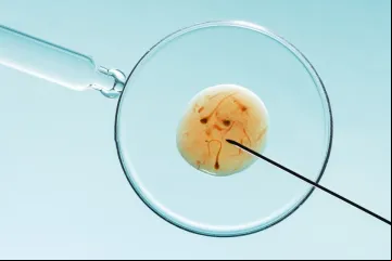 Fertilização in vitro
