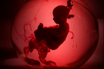 Aborto