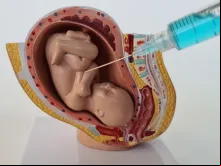 Imagem ilustrativa de uma assistolia fetal