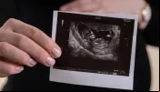 Igreja no Chile se mantém firme contra projeto de lei que libera aborto até a 14ª semana