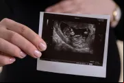Ultrassom de bebê no ventre materno. Imagem referencial.