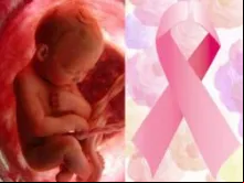 Estudos demonstram que o aborto aumenta o risco de câncer de mama em mulheres.