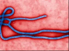 Vírus Ebola (Imagem Flickr The Global Panorama)