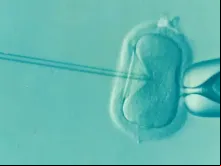 Fertilização In Vitro
