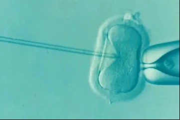FertilizacionInVitro-DrKontogianniIVF-DominioPublico-11112022.jpg