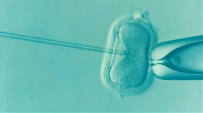 FertilizacionInVitro-DrKontogianniIVF-DominioPublico-11112022.jpg ?? 