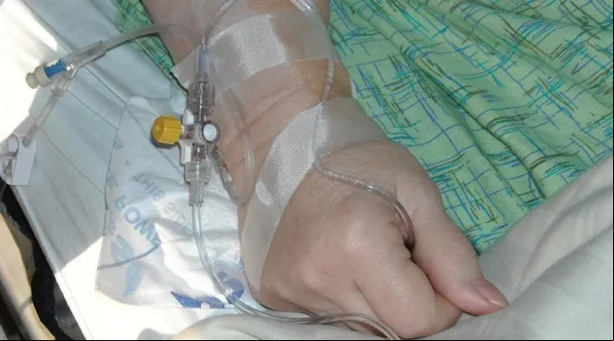 Intravenosa_Pixabay_280318.jpg ?? 