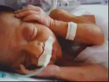 Márcia, após seu nascimento aos cinco meses e meio 