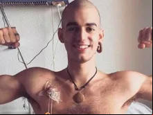 Pablo Ráez durante o tratamento contra a leucemia 