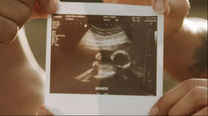UltrasonidoIndiana_240820_1.jpg ?? 