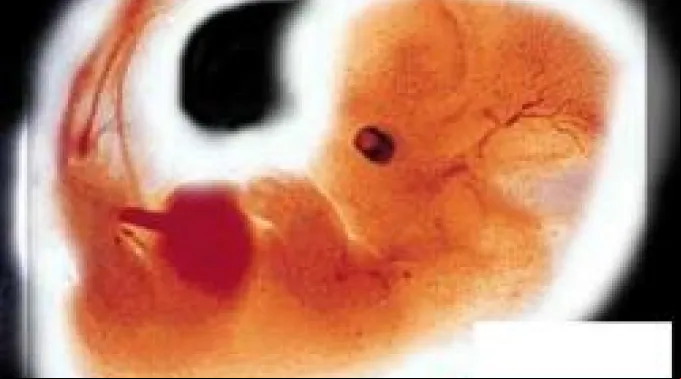 ppabortopolonia080711.jpg ?? 